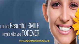 Dental Implants In Bangalore | Best Dental Implant Centre in Bangalore