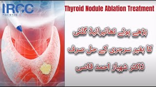 Thyroid Volume Reduction- Thyroid Nodule Ablation -Thyroid Cyst Ablation Thyroid procedures