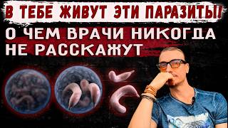 В тебе живут эти паразиты! О чем врачи никогда не расскажут.