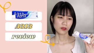 2 THÁNG DÙNG THỬ RETINOL A313 VÀ CÁI KẾT - A313 phù hợp da nào? Cách dùng A313 cho người mới bắt đầu