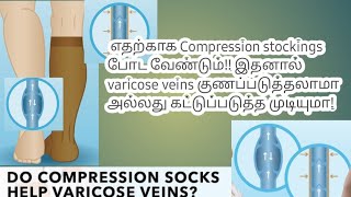 Compression stockings for varicose veins | Varicose veins treatment | Stockings for Varicose Veins