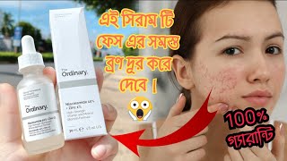 THE ORDINARY 10% NIACIMAMINDE FACE SERUM|| এই সিরাম টি ব্রণ এর উপর ১০০% কাজ করবে😍