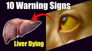 10 Warning Signs Your Liver Could Be in Danger! Are You at Risk?