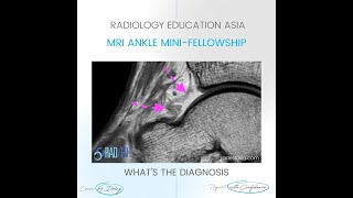 WHAT'S THE DIAGNOSIS: ANKLE JOINT SYNOVITIS