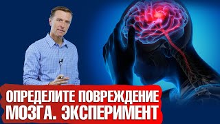 А у вас есть повреждение головного мозга?🧠 Проведите эксперимент и узнайте!