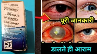 आँखों में दर्द, जलन, खुजली, Dryness, धुंधला दिखना , सब ठीक | Lubistar 0.5 eye Drops uses in hindi