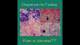 Окраска по Граму. Как и зачем?