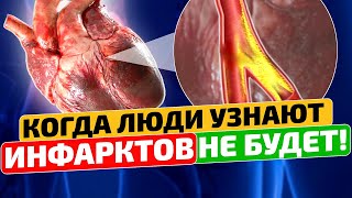 Старый доктор: ИНФАРКТ страшно боится этих 10 СУПЕР продуктов! Они укрепляют сосуды на долгие годы!