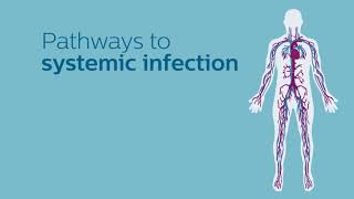 Pathways to Systemic Infection Animation