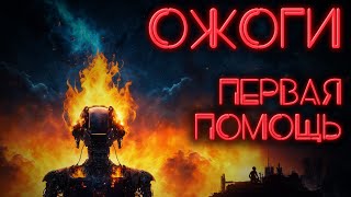 Первая помощь при ожогах. Как помочь в экстренной ситуации #ПроСМП