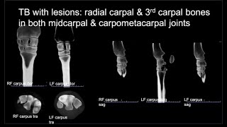 Knee Lesions Case Study