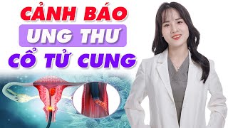 Tổng quan về UNG THƯ CỔ TỬ CUNG nguyên nhân, dấu hiệu, và các giai đoạn của bệnh | Bác sĩ Hoàng Hồng