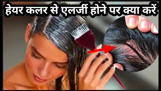 हेयर कलर से एलर्जी होने पर क्या करें | Hair colour se allergy | Hair colour se allergy ka ilaj.