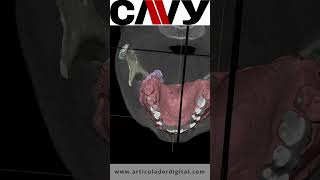 DICOM en Blender con el nuevo Cavy 4.6