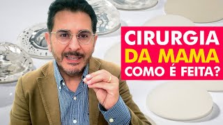 CIRURGIA DE MAMA: Como é Feita? - Dr. Samuel Colman