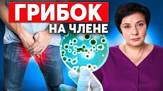 Белый налет, выделения и запах? Как избавиться от грибка на половых органах