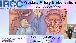 Benefits of Prostate Artery Embolization #PAE Best Prostate physician in Pakistan