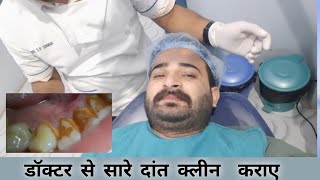 Teeth Cleaning By Dentist ! बिल्कुल सफेद हो गए दांत