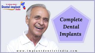 Best Dental Clinic in Bangalore | Fixed Bridges in Karnataka | Full Mouth Rehabilitation in India