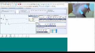 Вебинар о типичных ошибках при стимуляционной ЭМГ