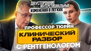 Клинические разборы с рентгенологом. Профессор Тюрин. Двусторонние интерстициальные изменения.