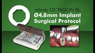 infinity OCTAGON BL 4.8mm RP Implant Surgical Protocol