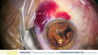 ITA - OCULAR SURFACE RECONSTRUCTION LIVE SURGERY - V. Ramovecchi (San Severino Marche, MC)