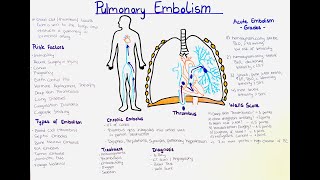 Understanding Pulmonary Embolism: Risk Factors, Symptoms, Diagnosis, Treatment and Prevention