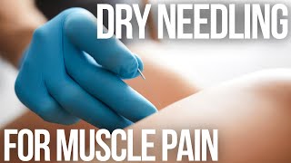 Dry Needling for Muscle Pain