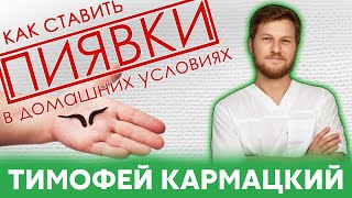 ПИЯВКИ. КАК СТАВИТЬ в домашних условиях? Тимофей Кармацкий