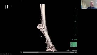 New Bone Production Case Study