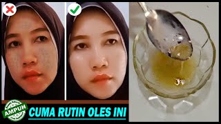 CARA MENGHILANGKAN FLEK HITAM  DENGAN CEPAT & WAJAH GLOWING BERCAHAYA