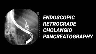 ERCP vs MRCP