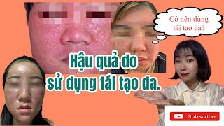 Tái Tạo da để lại những HẬU QUẢ và HỆ LUỴ gì cho da sau này?