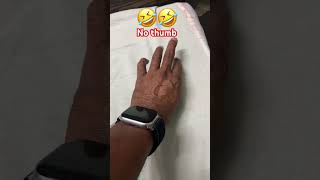 Hand without thumb magic,#funny #tranding #shorts