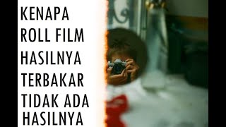 Kenapa Hasil Roll Film Kamera Analog Bisa Terbakar?