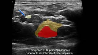 Supraescapular Nerve