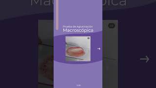 Aglutinación Macroscópica en  Veterinaria de pequeños animales ¿Anemia Hemolítica Inmunomediada?