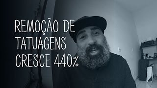 Remoção de tatuagens cresce em 440%. Isso é um bom sinal...