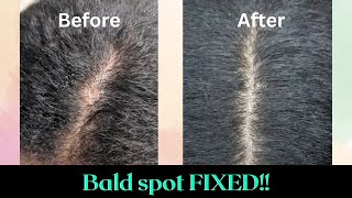 How I fixed a Bald Spot