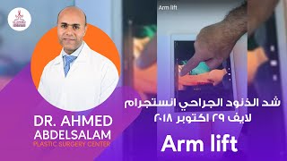 شد الذنود الجراحي انستجرام لايف ٢٩ اكتوبر ٢٠١٨ Arm lift