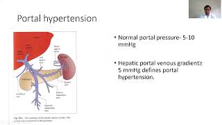 Cirrhosis -Part Two|Complications of Cirrhosis|Dr. Bhupendra Shah|Medicine classroom