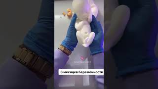 с днём семьи #семья #дети #kids #юшко #топ #ортопед #вирусное