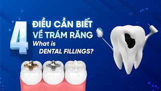 4 Điều về trám răng có thể bạn chưa biết ?