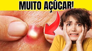 10 SINAIS DE QUE VOCÊ ESTÁ COMENDO MUITO AÇÚCAR l DEPOIS DOS 50