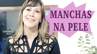 Manchas...o que fazer?