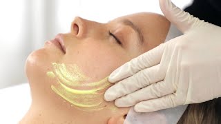 How Do Chemical Peels Work? The Clinic Bondi