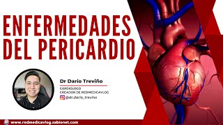 Enfermedades del pericardio #ENARM | 🩺Dr. Treviño