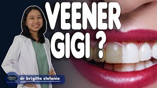 IDYAKIN KAMU MAU VEENER GIGI ?