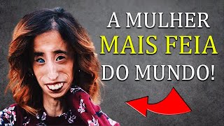 BULLYING! A Incrível História da MULHER MAIS FEIA do Mundo! Lizzie Velasquez | Histórias reais